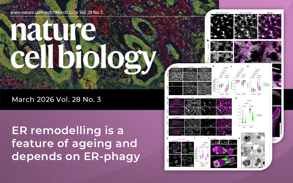 Nature Cell Biology Publication MacGurn Lab